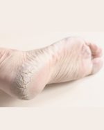 Kit para pedicure (pies suaves) - Dr.Kralle - Imagen 7