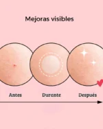 Parches para espinillas - Nolahour - Imagen 4