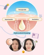 Parches para espinillas - Nolahour - Imagen 2